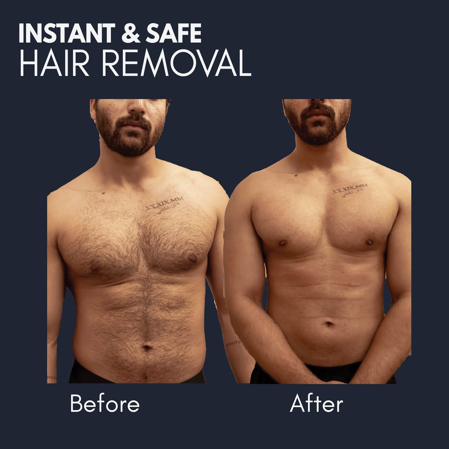 OMG Hair Removal Spray for Men | Painless Body Hair Removal pray for Chest Back Hands Legs and Intimate Areas | with Coffee Fragrance Shea Butter and Glycerine | Works in less than 10 Minutes| 200ml